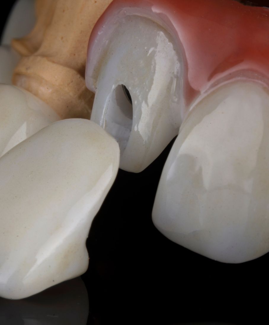 casos clinicos clinica miguel vieira