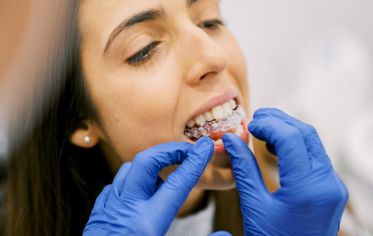 invisalign5