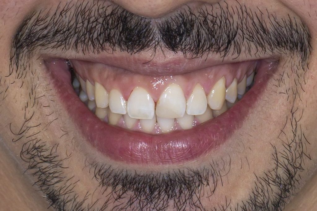 Dentisteria - Clínica Miguel Vieira